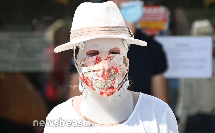 Επίθεση με βιτριόλι: «Η μάσκα που φοράει η Ιωάννα είναι η θεραπεία της»