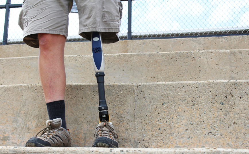 Στέκεται άνθρωπος με προσθετικό πόδι Στέκεται άνθρωπος με προσθετικό πόδι