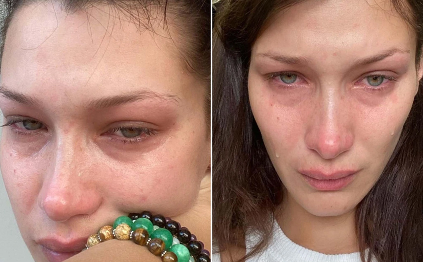 Η Bella Hadid πόσταρε στο Instagram φωτογραφίες της δακρυσμένη – «Κλαίω σχεδόν κάθε μέρα και νύχτα εδώ και χρόνια»