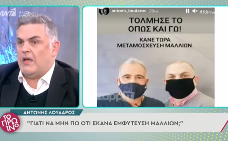 Ο Γιώργος Λιάγκας ξάφνιασε τον Αντώνη Λουδάρο: «Δεν φαίνεται καθόλου η εμφύτευση μαλλιών»