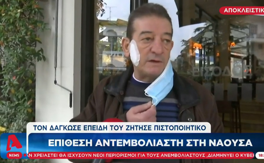 Νάουσα: «Μου ‘δωσε γροθιά και με δάγκωσε στο μάγουλο» λέει ιδιοκτήτης καφετέριας για πελάτη που του ζήτησε πιστοποιητικό
