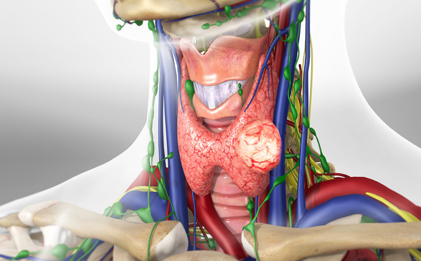 Επεμβάσεις θυρεοειδούς: Πόσο σημαντική είναι η επιλογή του κατάλληλου χειρουργού