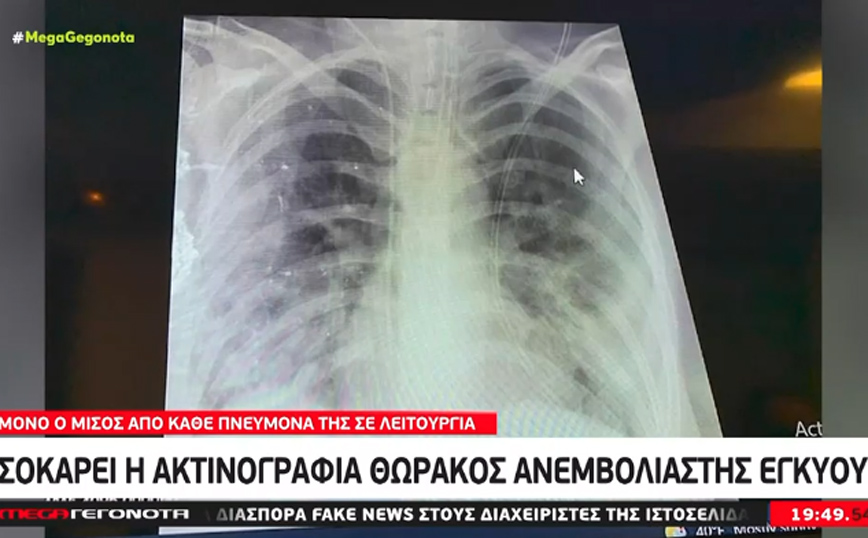 Αγωνία για 10 γυναίκες στο Ιπποκράτειο που γέννησαν πρόωρα λόγω κορονοϊού