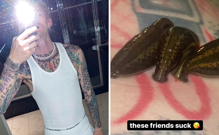 Machine Gun Kelly: Πόσταρε βίντεο με βδέλλες να ρουφούν το αίμα του στο στήθος του