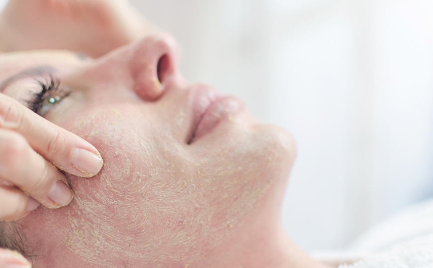 Απολέπιση προσώπου