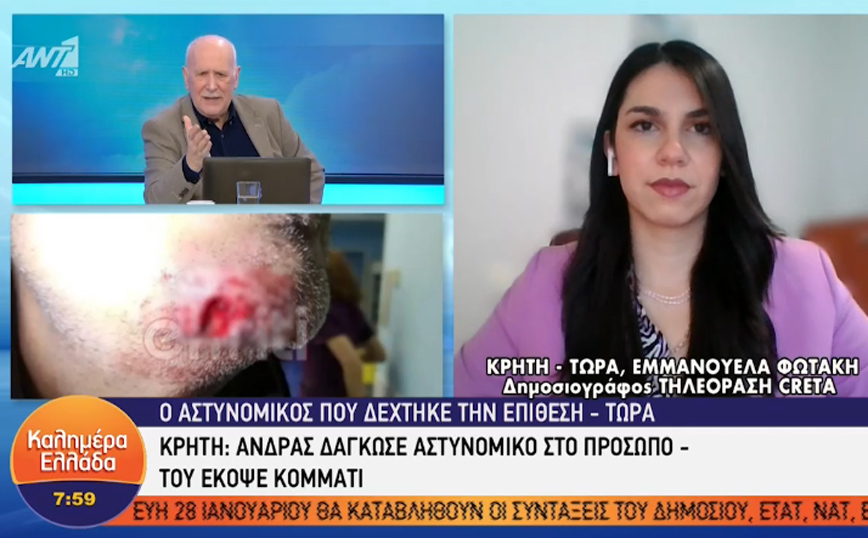 Κρήτη: Αστυνομικός πήγε να κάνει έλεγχο και τον δάγκωσε στο σαγόνι- «Οι συνάδελφοι μού είπαν “σου λείπει κομμάτι”»