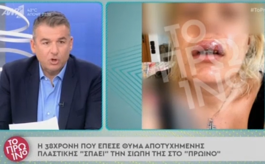 Σπάει τη σιωπή της η γυναίκα που μήνυσε πλαστικό χειρούργο: «Μου είπε “πάρε 5.000 ευρώ και φύγε από εδώ”»