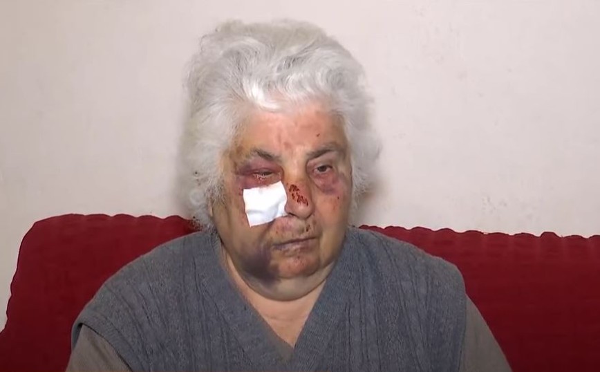 Σοκάρει η μαρτυρία ηλικιωμένης στο Αιγάλεω: Τη χτύπησαν άγρια ληστές στο σπίτι της – «Θα με σκότωναν»