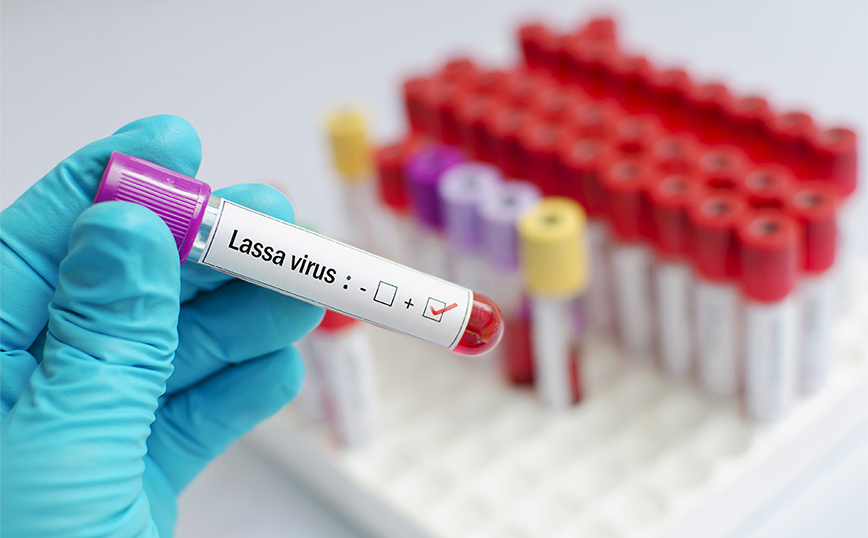 Πέθανε το ένα από τα τρία κρούσματα με τον αιμορραγικό πυρετό Lassa στη Βρετανία