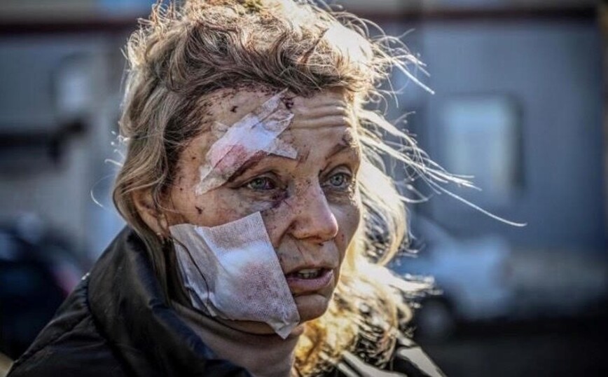 To συγκλονιστικό μήνυμα του φωτορεπόρτερ Άρη Μεσσήνη από την Ουκρανία: «Μην υποστηρίζεις κανέναν σε έναν πόλεμο»