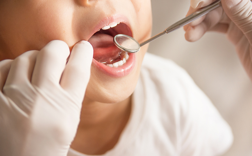 Dentist Pass: Η διαδικασία για την υποβολή αιτήσεων και η πίστωση της οικονομικής ενίσχυσης