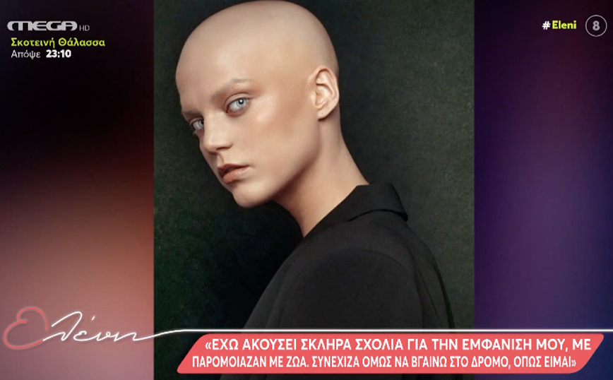 Δωροθέα Ιατρού: Από τα ξανθά μαλλιά στην αλωπεκία – «Ένιωθα λίγο αδικημένη, έχω ακούσει σκληρά σχόλια»
