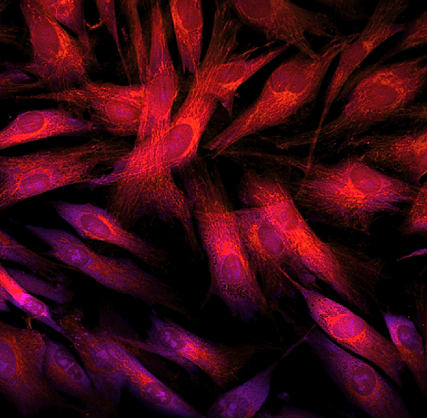 fibroblasts κύτταρα fibroblasts κύτταρα