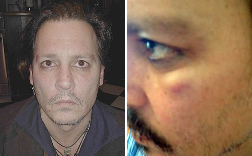 Ο Τζόνι Ντεπ με μελανιά στο προσωπο Ο Τζόνι Ντεπ με μελανιά στο προσωπο