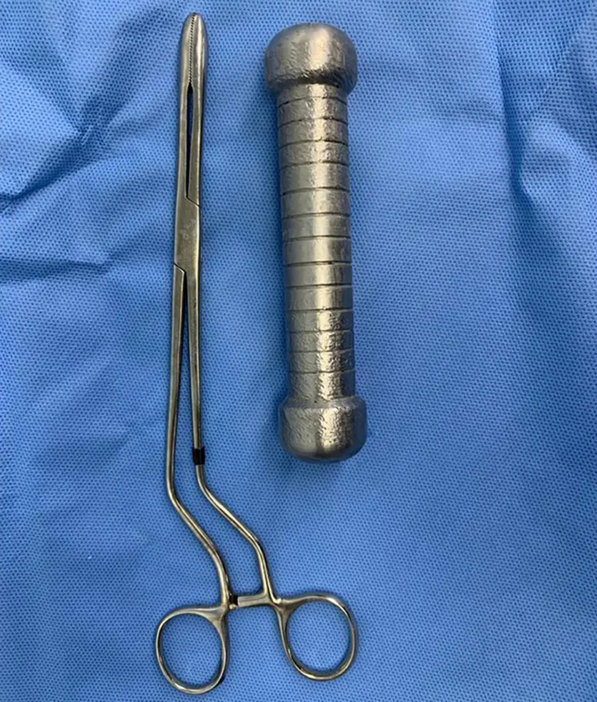 Βαράκι σε ακτινογραφία