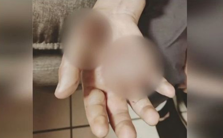 Νέα Σμύρνη: Φρίκη για 10χρονη στα χέρια του πατέρα της – Ιατροδικαστής επιβεβαίωσε τη σεξουαλική κακοποίηση
