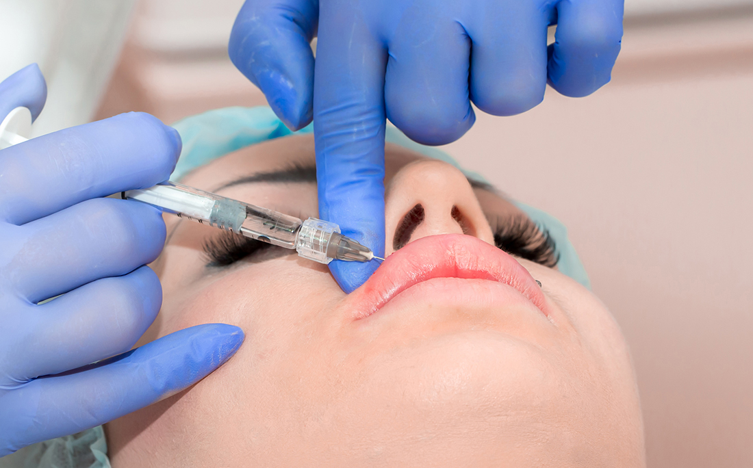 αυξητική χειλιών αυξητική χειλιών