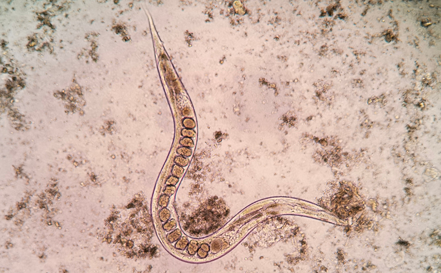 Το στρογγυλό σκουλήκι που ονομάζεται Strongyloides stercoralis Το στρογγυλό σκουλήκι που ονομάζεται Strongyloides stercoralis