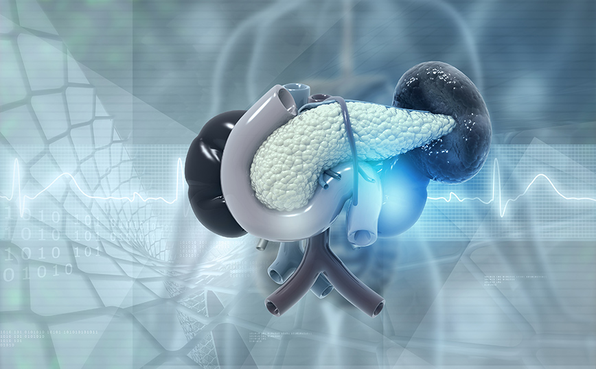 Τεχνητό πάγκρεας Τεχνητό πάγκρεας