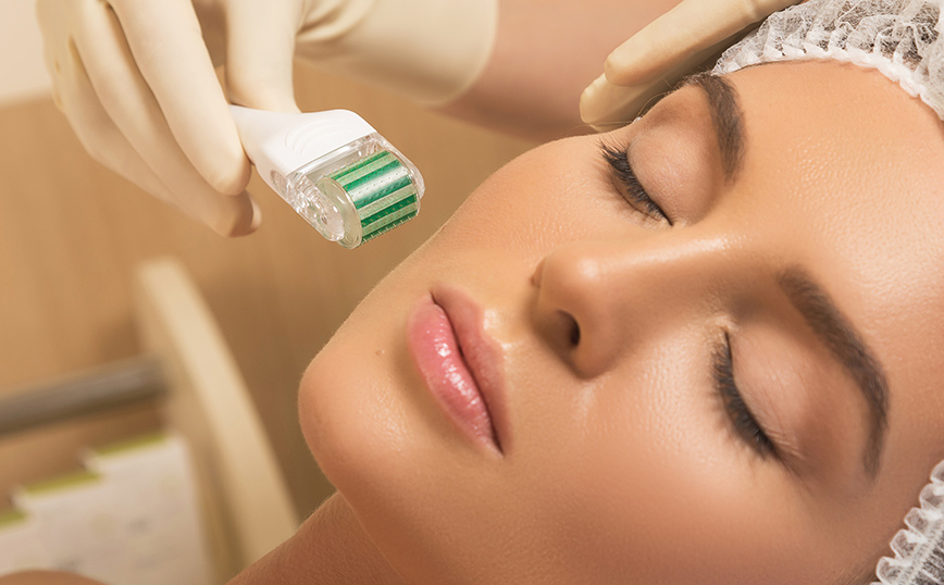 Microneedling: Τι είναι και πόσο καλό κάνει στην επιδερμίδα