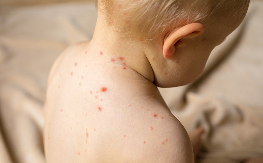 Παιδάκι με ανεμοβλογιά Παιδάκι με ανεμοβλογιά