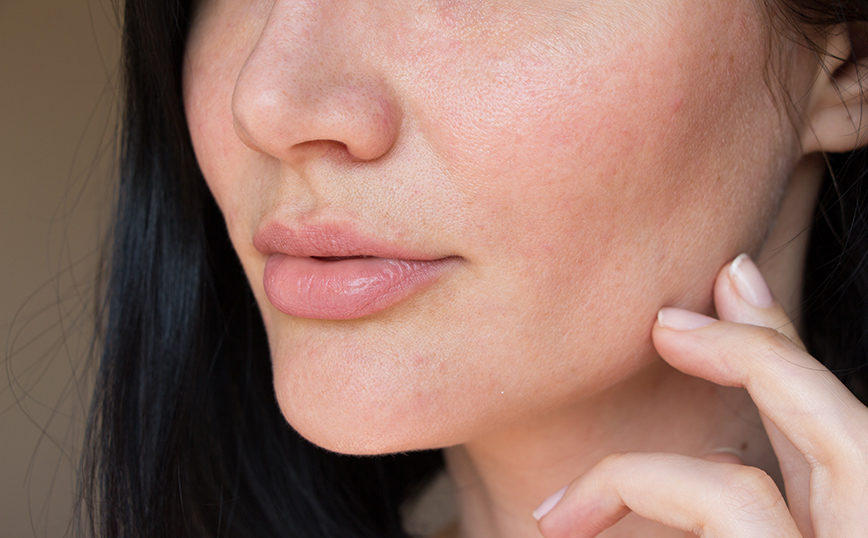 Περιποίηση ξηρού δέρματος Περιποίηση ξηρού δέρματος