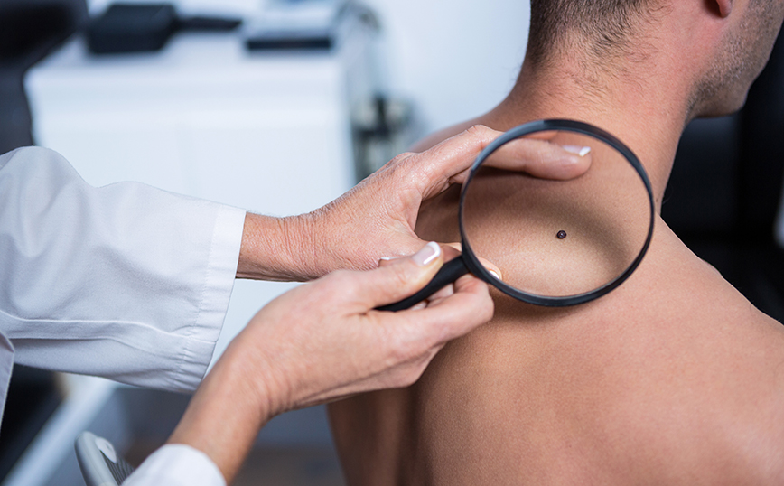 Δερματολόγος που εξετάζει μια ελιά