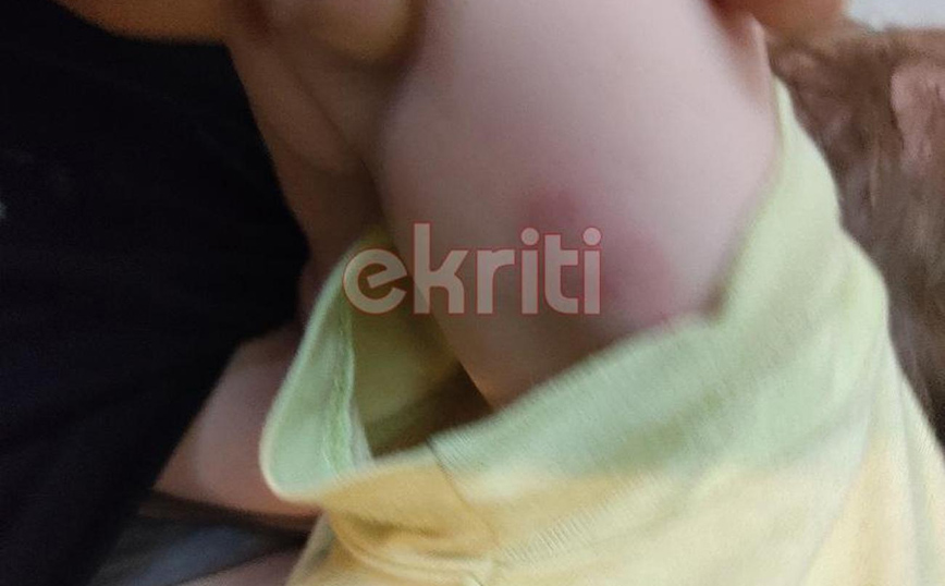 Ηράκλειο: Σοκαριστικές εικόνες από την επίθεση σκύλου σε 8 μηνών μωρό