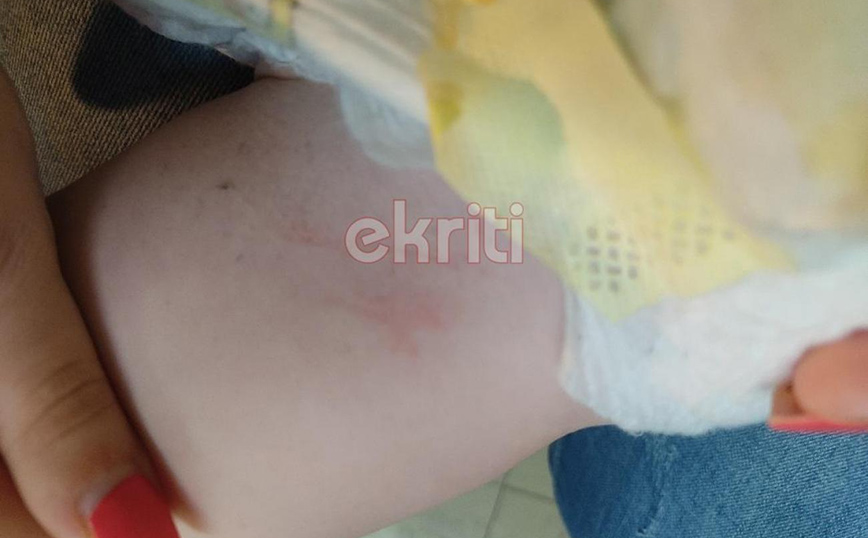 «Το τράβηξα αλλά σηκώθηκε και γρατζούνισε το μωρό στο κεφάλι» – Τι λέει η ιδιοκτήτρια του λυκόσκυλου