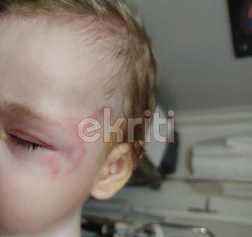 Εικόνες - σοκ από την επίθεση του σκύλου στο βρέφος