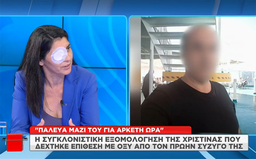 Μεσσήνη: «Ούρλιαζα, καιγόμουν – Ήταν σαν να μου είχαν βάλει φωτιά», λέει η Χριστίνα για την επίθεση με οξύ από τον πρώην σύζυγο