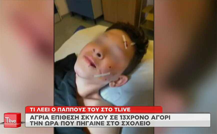Λαγονήσι: «Ένας κύριος έδιωξε το σκυλί – Θα το σκότωνε», λέει ο παππούς του παιδιού που δέχτηκε επίθεση