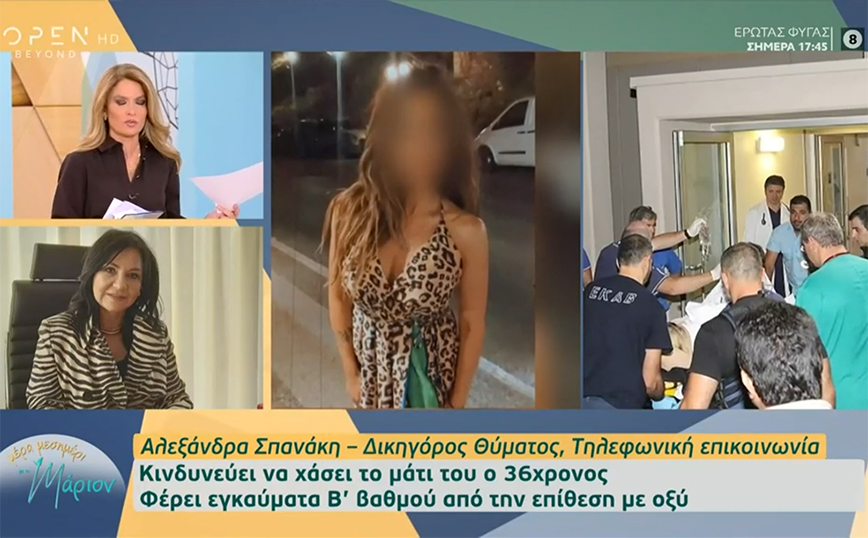Επίθεση με καυστικό υγρό: «Η κόρη μου λέει ψέματα – Δεν την είχε πειράξει», λέει ο πατέρας της 38χρονης