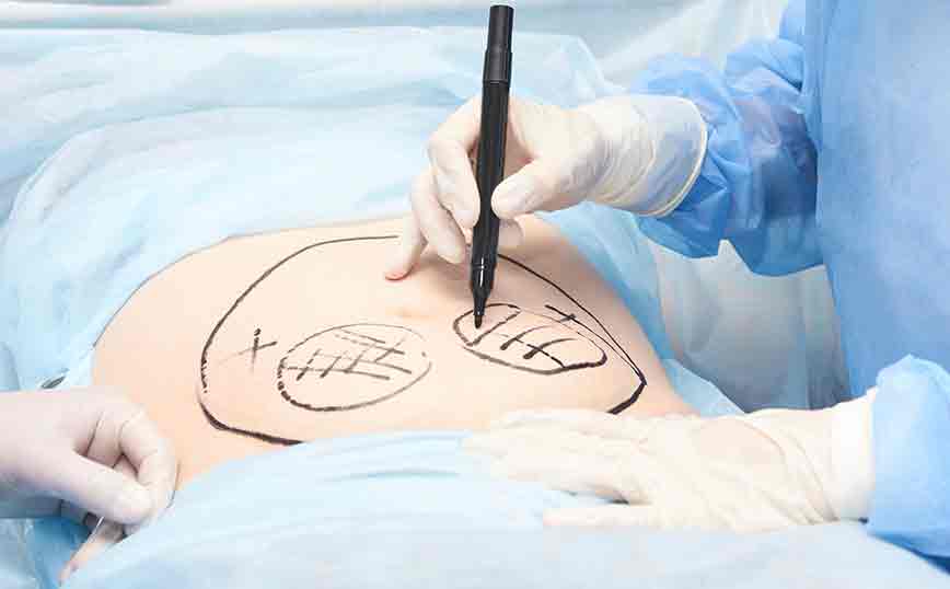 Χειρουργείο κοιλιά Χειρουργείο κοιλιά