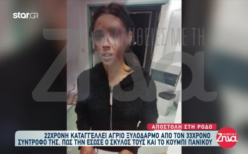 Η βαφτιστήρα του Τριαντάφυλλου έπεσε θύμα άγριου ξυλοδαρμού – «Θα με σκότωνε και δεν θα το έπαιρνε κανείς είδηση»
