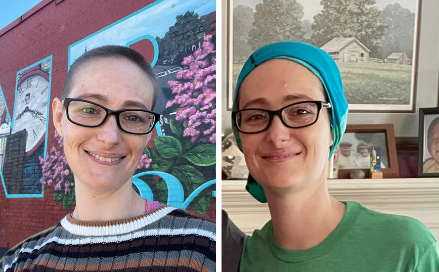 Έχασε τα μαλλιά της στις χημειοθεραπείες για τον καρκίνο και την κορόιδευαν σε συνέντευξη για δουλειά