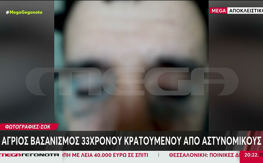 Κρατούμενος καταγγέλλει αστυνομικούς για βασανισμό: Μάνα σώσε με γιατί με σκοτώνουν – Θα πάρετε το παιδί σας σε κάσα