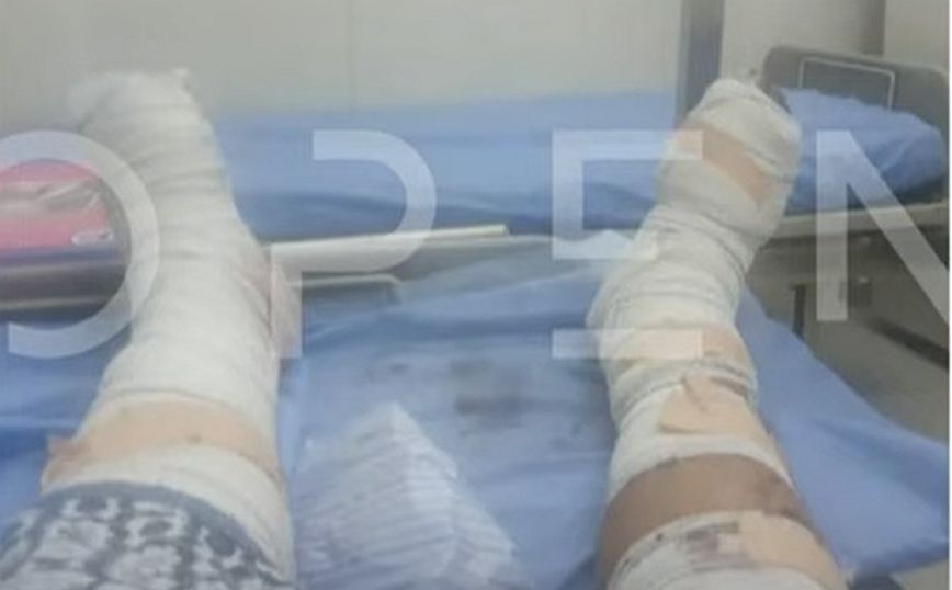 Φωτογραφία ντοκουμέντο από Έλληνα τραυματία στο Σουδάν &#8211; Οι γιατροί δεν μπορούν να φτάσουν στο νοσοκομείο