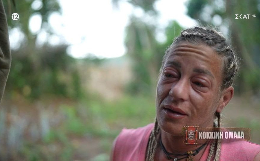 Survivor All Star: Στο νοσοκομείο άρον – άρον η Αφροδίτη Σκαφίδα