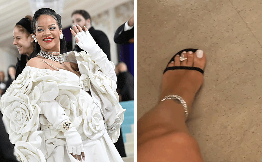 Η Ριάνα φόρεσε στο δάχτυλο του ποδιού διαμαντένιο δαχτυλίδι αξίας 1 εκατομμυρίου δολαρίων