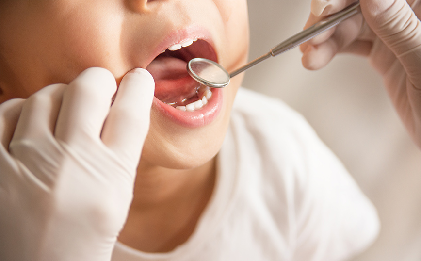 Dentist pass για παιδιά: Νέοι δικαιούχοι – Tι καλύπτει το πρόγραμμα – H διαδικασία των αιτήσεων