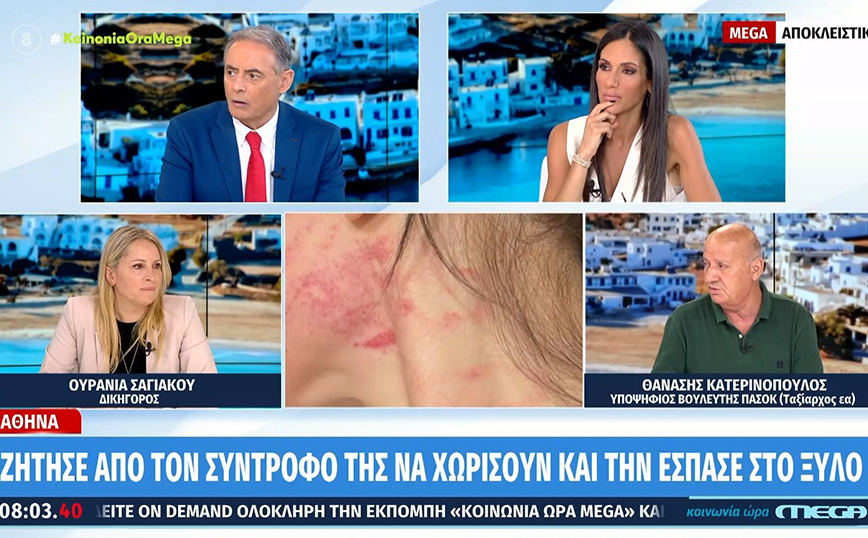 Ζήτησε από το σύντροφό της να χωρίσουν και την έσπασε στο ξύλο &#8211; «Όπου βρίσκει την κοπέλα, στο δρόμο, στη δουλειά, την ξυλοκοπεί»