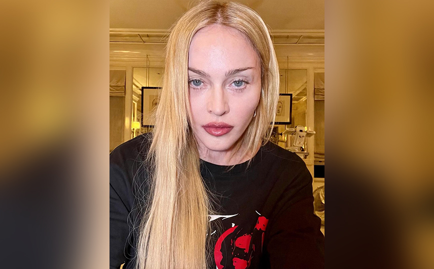 Madonna: «Είμαι στον δρόμο της αποθεραπείας» &#8211; Το πρώτο μήνυμα της pop star μετά την έξοδο από το νοσοκομείο