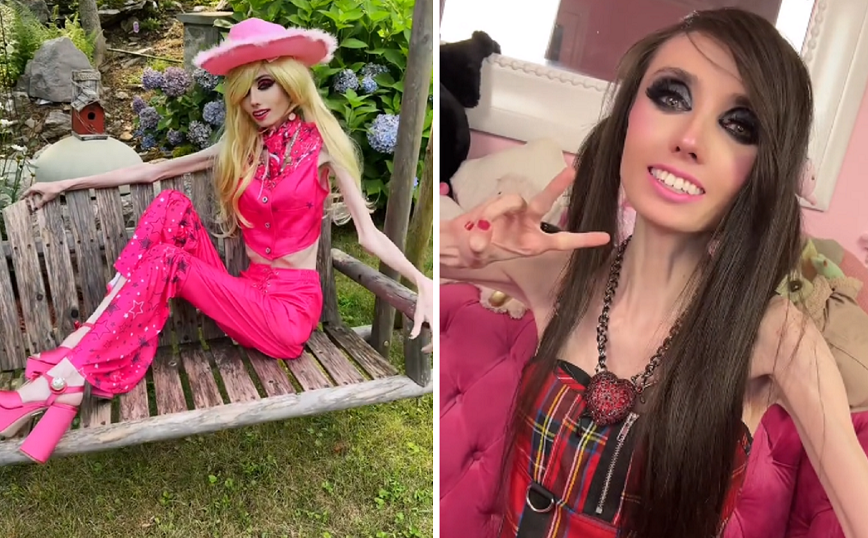 YouTuber με ανορεξία «ντύθηκε» Barbie και προβλημάτισε για την υγεία της – «Χτυπά κυριολεκτικά την πόρτα του θανάτου»