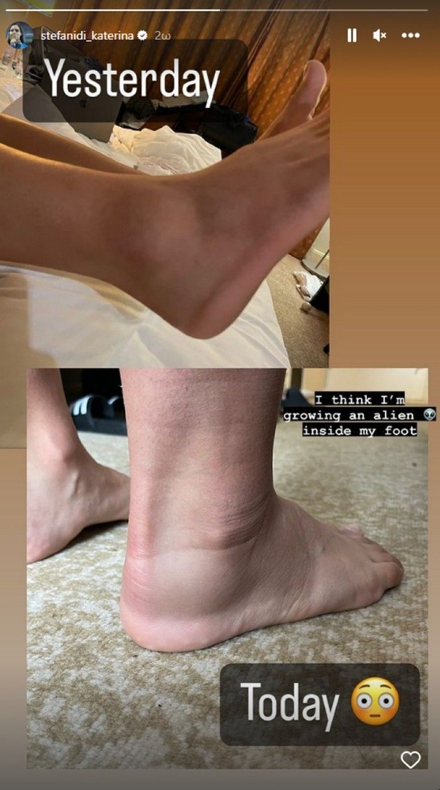 Κατερίνα Στεφανίδη πόδι