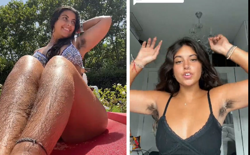 Μοντέλο του Onlyfans εκτόξευσε την καριέρα της όταν σταμάτησε να ξυρίζεται – «Ένα χαριτωμένο τριχωτό κορίτσι»