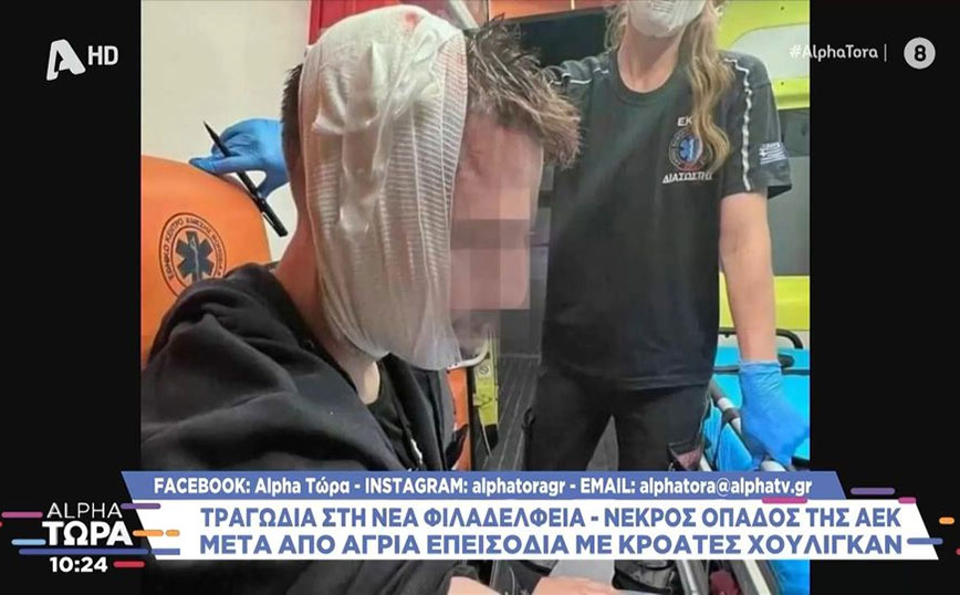 Συγκλονιστική φωτογραφία τραυματία της επίθεσης Κροατών χούλιγκαν στη Νέα Φιλαδέλφεια – Δεμένο με επιδέσμους το κεφάλι του