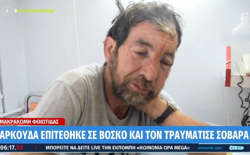 Συγκλονίζει ο βοσκός που δέχτηκε επίθεση από αρκούδα: «Περπάταγα και πήδηξε στο κεφάλι μου»