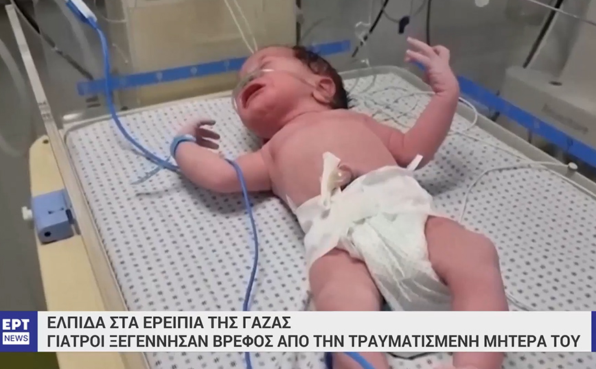 Τραυματισμένη Παλαιστίνια κατάφερε να γεννήσει ένα υγιέστατο μωρό – Οι υπεράνθρωπες προσπάθειες των γιατρών