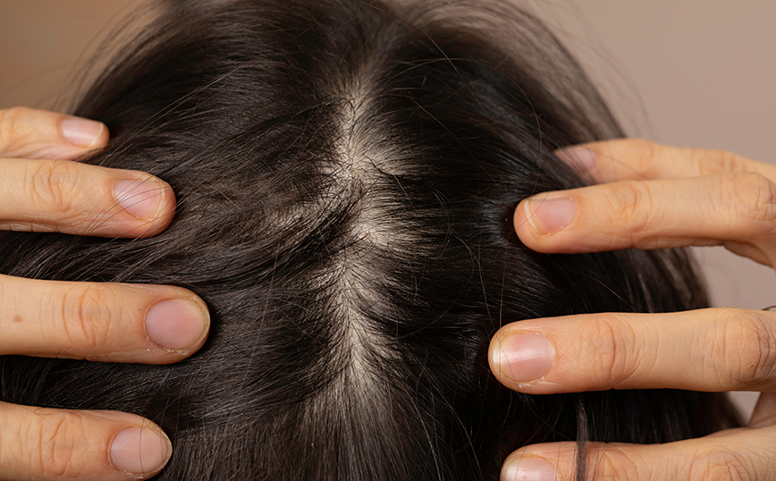 Χωρίστρα Χωρίστρα